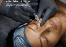 exo booster microneedling